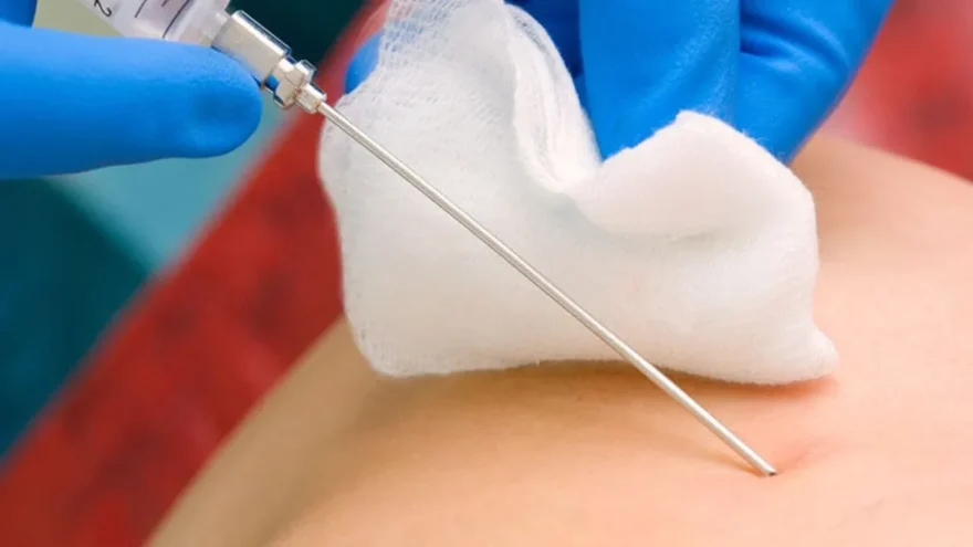 Mersin’de Biyopsi Sonrası Ölüm: İhmal İddiası Gündemde