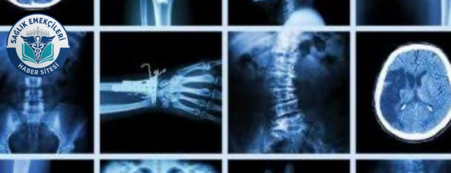 Radyoloji Skandalı İddiası: Savcılık Harekete Geçti: Yanlış Raporlar Mercek Altında! – Sağlık Emekçileri Haber Kanalı