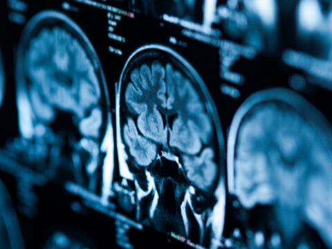 Zihnindeki sesler hayatını kurtardı: Tıp tarihinin en gizemli teşhis hikayesi