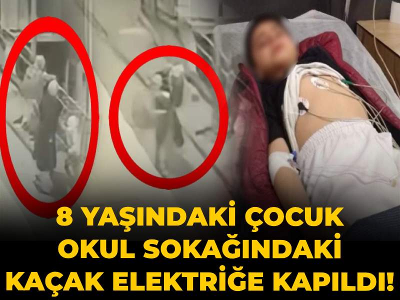 8-yasindaki-cocuk-okul-sokagindaki-kacak-elektrige-kapildi-annesi-omrumuzden-gitti-diyerek-anlatti-l4NtYrqF.jpg
