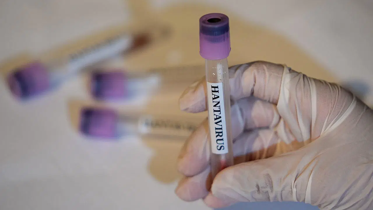avrupada-hantavirus-alarmi-12-saglik-calisani-karantinada-gATydUHZ.jpg