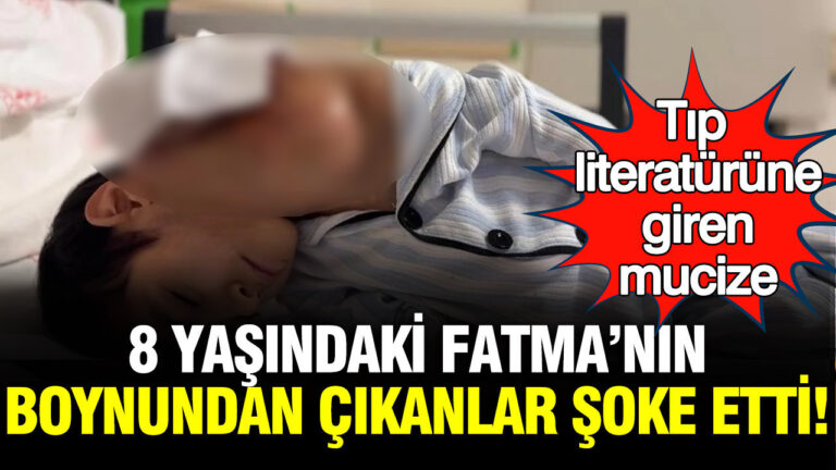 dunya-bu-mucize-vakayi-konusuyor-eskisehirde-8-yasindaki-fatmanin-cikan-kitle-tip-tarihini-degistirdi-jLUB7rlX.jpg