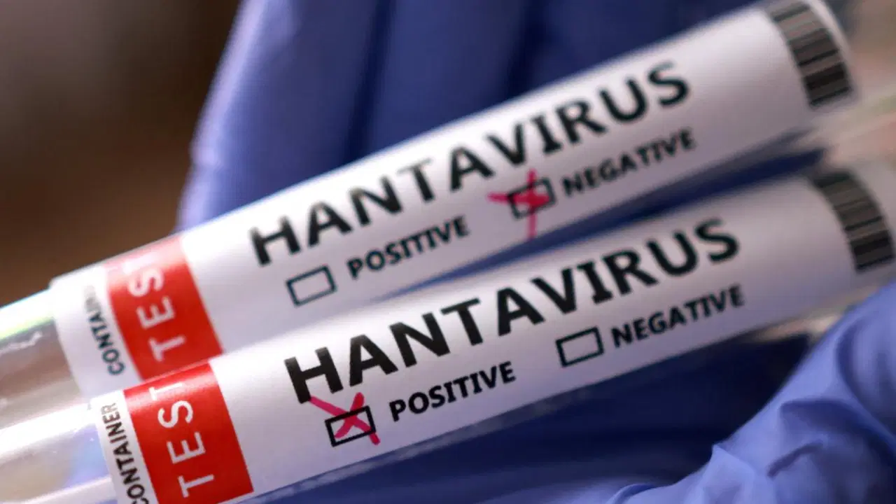 hantavirus-vakalari-neden-artiyor-uzman-isim-acikladi-TqR7dQLE.jpg