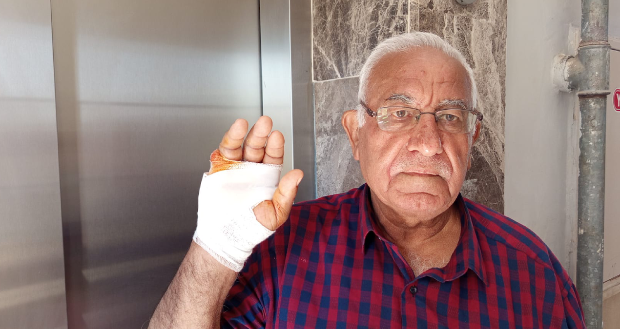 hatayda-akilalmaz-olay-cok-sevdigi-komsusu-parmagini-isirarak-kopardi-k8engeu2.jpg