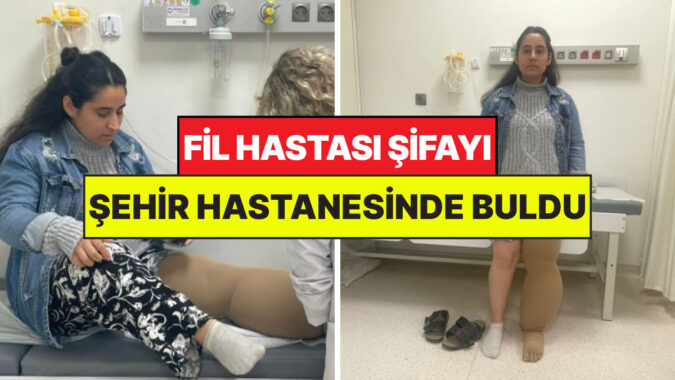 İstanbul’da Fil Hastası 4 Yıl Sonra Şehir Hastanesinde Şifa Buldu