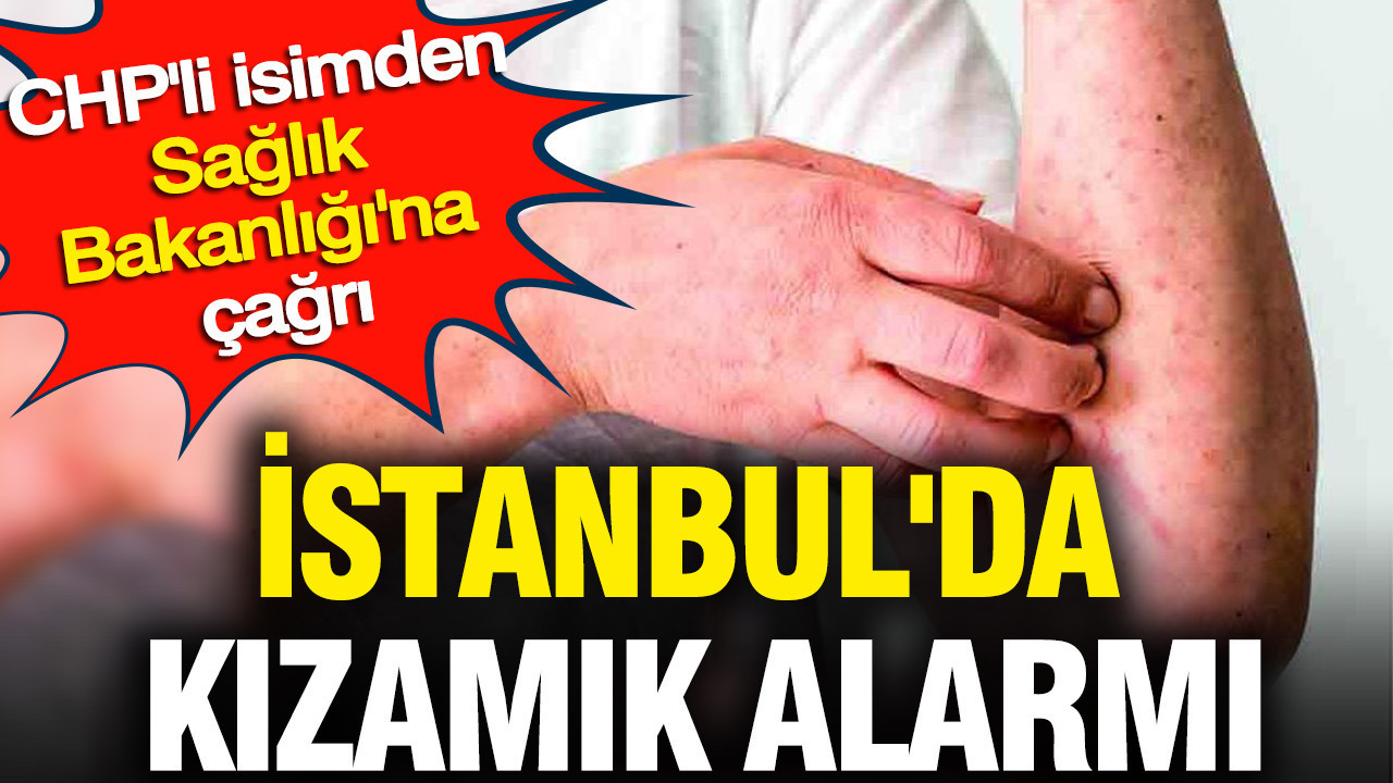istanbulda-kizamik-alarmi-chpli-isimden-saglik-bakanligina-cagri-IdP2NmOx.jpg