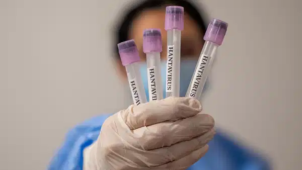 profesorden-dikkat-ceken-hantavirus-aciklamasi-yeniden-bir-pandemi-ihtimali-yok-ama-tedbir-sart-GOb5IcN5.jpg
