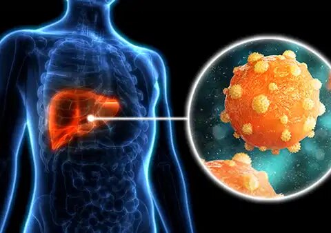 300 milyondan fazla kisi enfekte viral hepatitlere dikkat c5PwmEV1.jpg