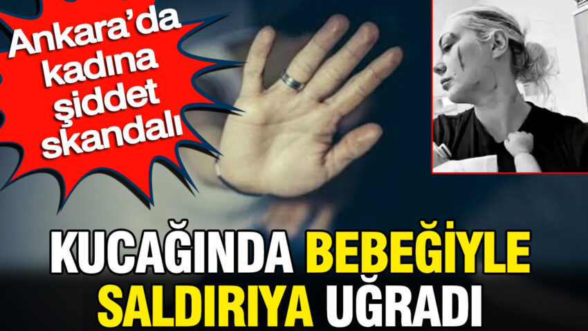 Ankarada kadina siddet skandali kucaginda bebegiyle saldiriya ugradi KQXVRiTw.jpg
