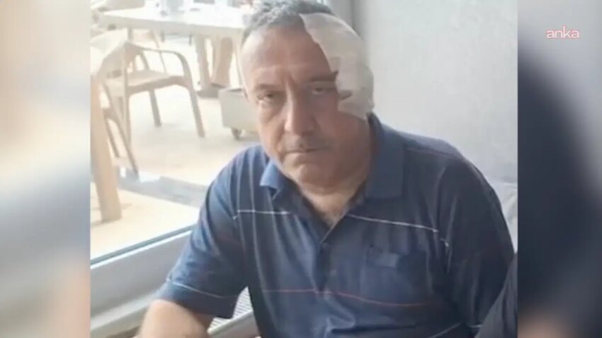 Asi takibi icin aileyi aradi saldiriya ugradi sinopta saglik personeline darp aQchEpN5.jpg