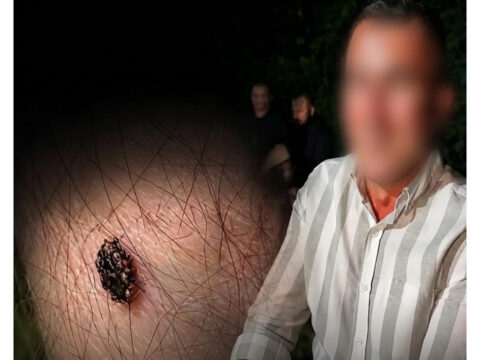 Bacaginda keneyle soz kesti torenden sonra besiye aldik dedik 9Q65Tqtp.jpg