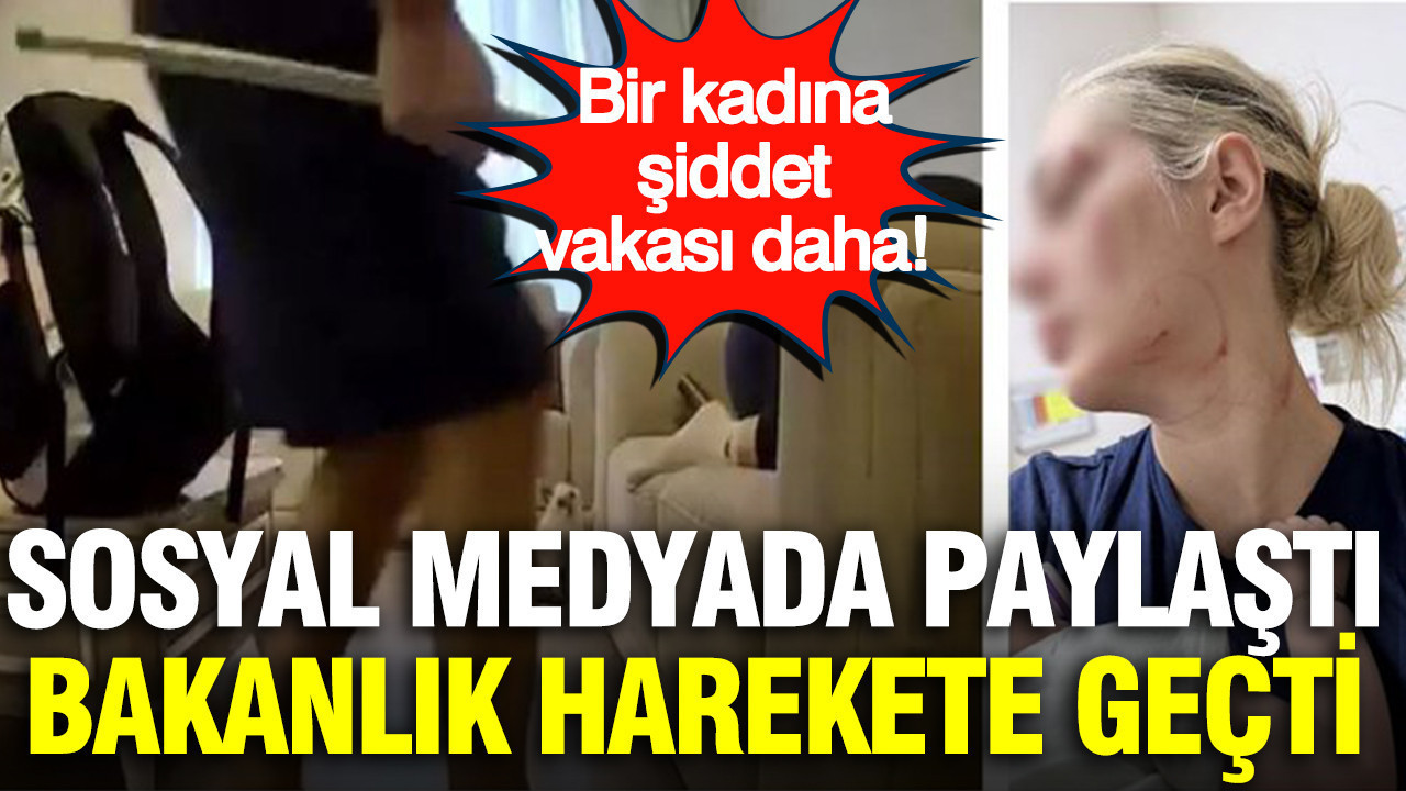 Bir kadına şiddet vakası daha: Sosyal medyada paylaştı bakanlık harekete geçti