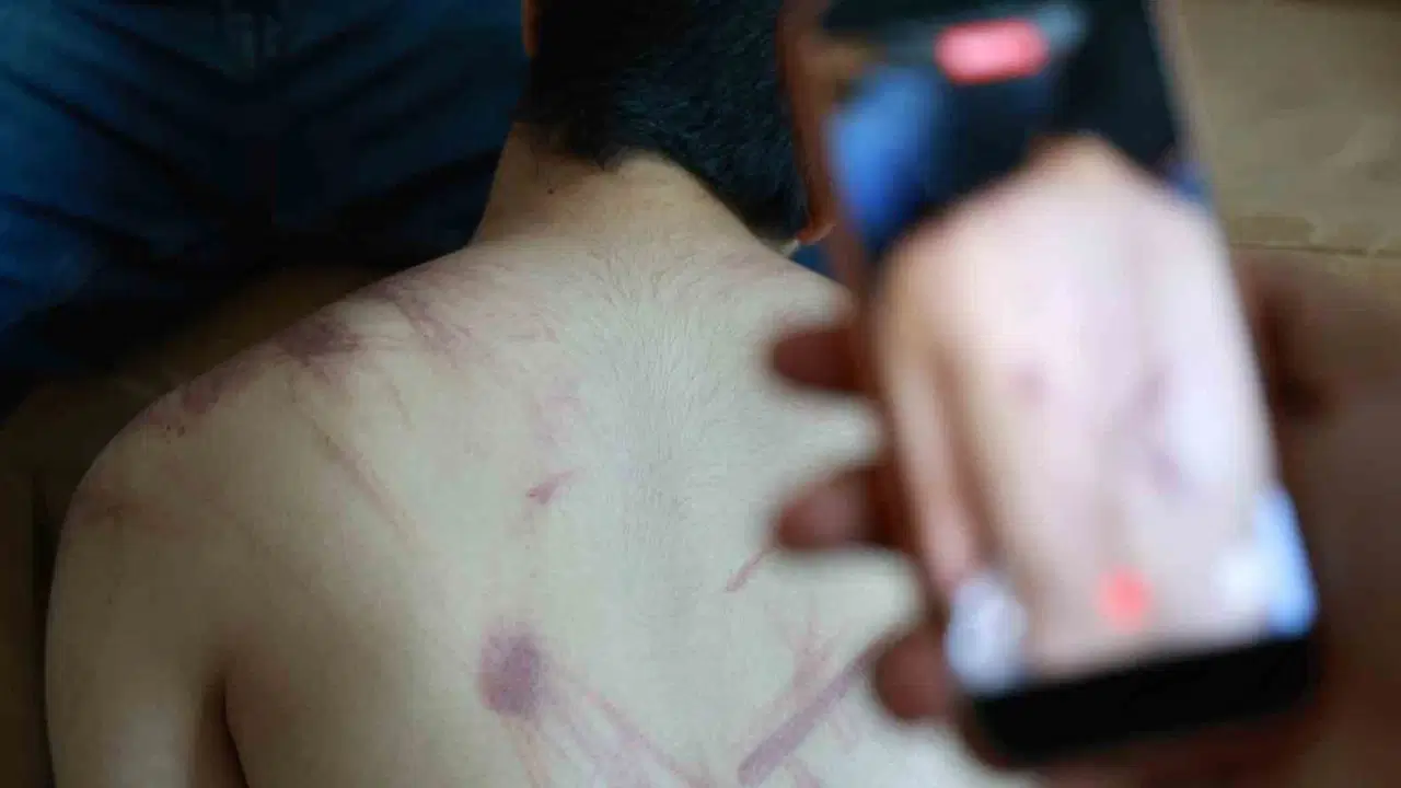 Elazığ’da rehabilitasyon merkezinde ‘şiddet’ iddiası: Adli ve idari soruşturma başlatıldı