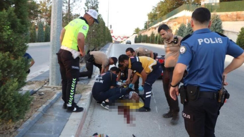 Elektrikli bisiklete carpip kacti agir yaralanan surucu yasam mucadelesi veriyor FzDNs6XC.jpg