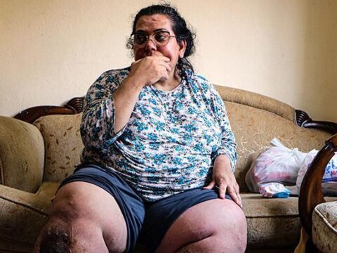 Fil hastasi 3 cocuk annesi tedavi olmak icin yardim bekliyor yaralarda kurtlanma olusuyor Qq9KkhhL.jpg