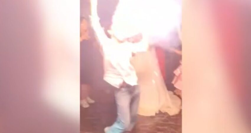 Gelin ve damadin yaninda dehseti yasadi agzina koydugu mesale yuzunde patladi mxY9E7gf.jpg