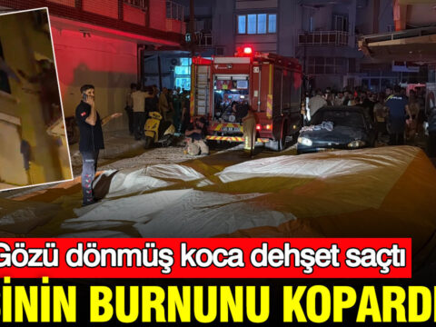 Gozu donmus koca dehset sacti esinin burnunu kopardi manisada hareketli anlar vGWUZPGP.jpg
