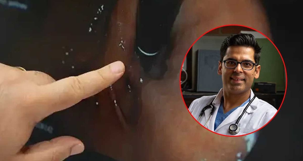 Harvardlı Doktor ‘detoksa gerek yok’ dedi, bağırsakları genç tutmanın 4 formülünü verdi