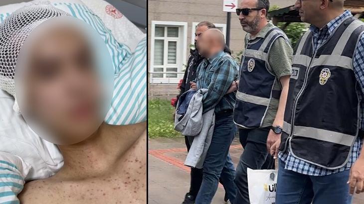 Komadan cikti her seyi anlatti tacize direndigi iddiasiyla basindan vurulan cocuk felc kaldi pOn3z4Ve.jpg
