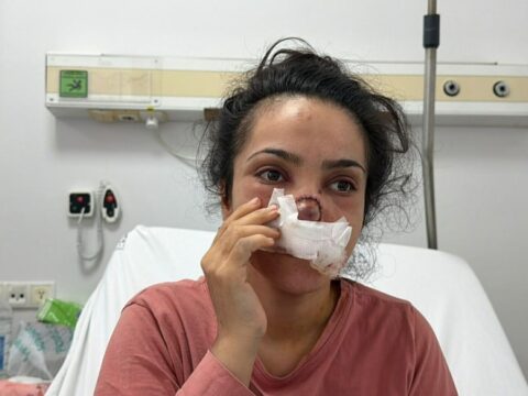 Manisada yamyamlik dehseti burnu koparilan kadin o anlari anlatti sOa6ZZxf.jpg