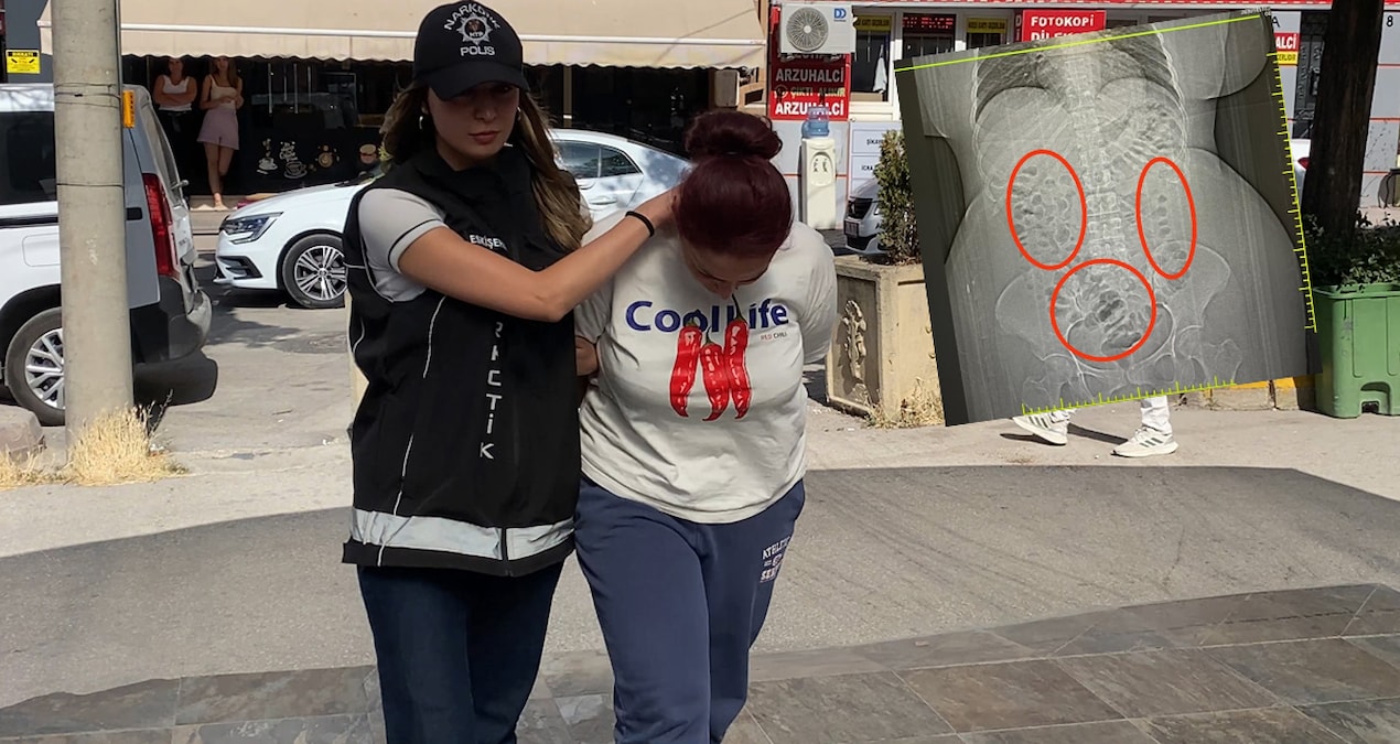 Midesinden çıktı, hemen gözaltına alındı