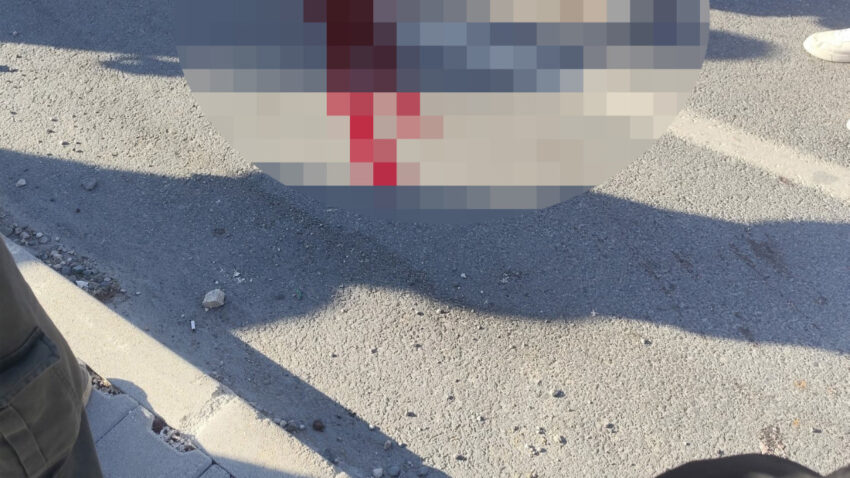 Topunun pesinden yola kosan 11 yasindaki umut kamyonetin carpmasiyla hayatini kaybetti fDCRa1Os.jpg