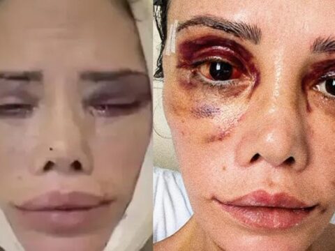 Yuz nakli olan survivor didem ceran son halini paylasti hepinizden cok ozur diliyorum evhTQ4Ra.jpg