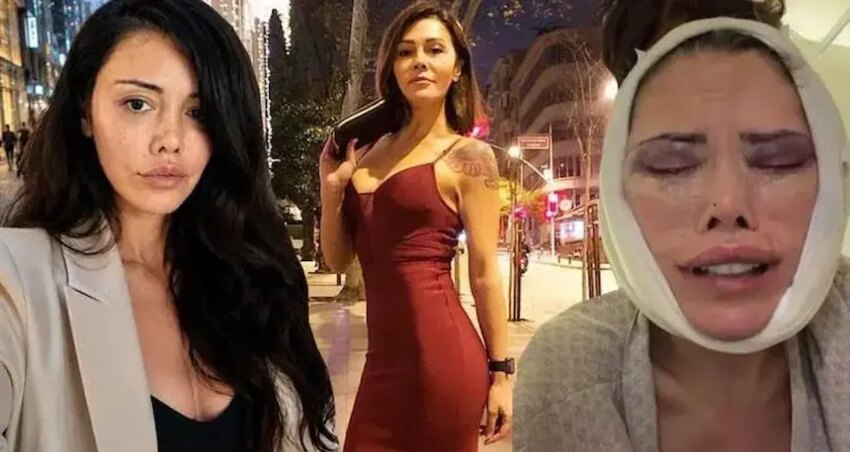 Yuz nakli yaptiran didem ceran gozyaslariyla anlatti beni sikayet ediyorlar VK57yZsE.jpg
