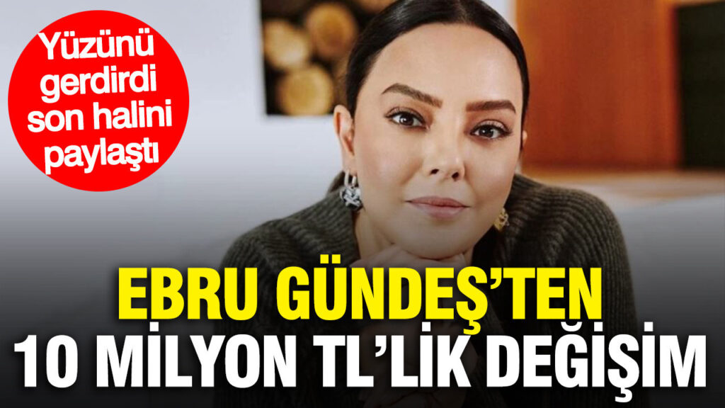ebru-gundesten-10-milyon-tllik-degisim-yuzunu-gerdirdi-son-halini-paylasti-417DbL2A.jpg